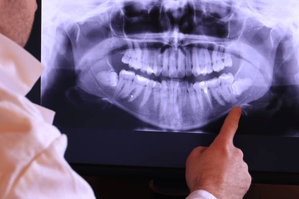 Best Emergency Broken Tooth Repair in Wheeler Af, HI